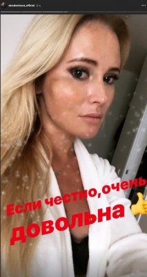 Изменившаяся после пластики Дана Борисова продемонстрировала жуткие синяки
