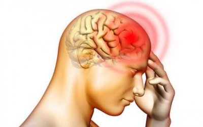 Доктор Мясников рассказал, какая головная боль указывает на рак мозга
